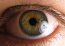 La conjuntivitis crónica y el síndrome del ojo seco afectan al 30 por ciento de los españoles | Salud Visual 2.0 | Scoop.it