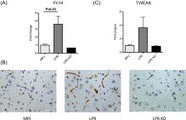 ScienceDirect.com - Journal of Autoimmunity - Neuropsychiatric disease in murine lupus is dependent on the TWEAK/Fn14 pathway | NeuroImmunology | Scoop.it