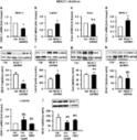 Toward dissecting the etiology of schizophrenia: HDAC1 and DAXX regulate GAD67 expression in an in vitro hippocampal GABA neuron model | Vectorology - GEG Tech top picks | Scoop.it