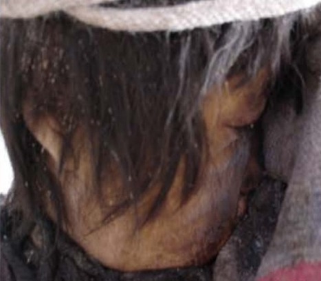 Sur les traces de la r&eacute;ponse immunitaire d&rsquo;une momie inca vieille de 500 ans. | Caf&eacute; des Sciences | Scoop.it