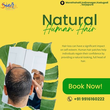 Discover Transformation with Human Hair Patches | hair fixing in bangalore | Scoop.it