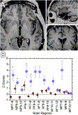 Electrical stimulation of a small brain area reversibly disrupts consciousness | Bioscience News - GEG Tech top picks | Scoop.it