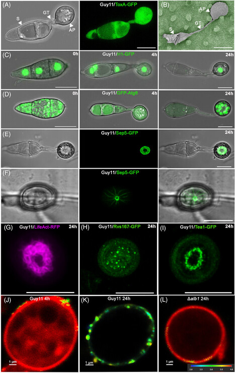 J Microscop: Live cell imaging of plant infection provides new insight into the biology of pathogenesis by the rice blast fungus Magnaporthe oryzae (2025) | Publications from The Sainsbury Laboratory | Scoop.it