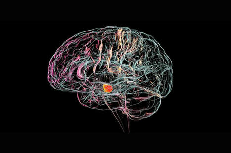 Scientists Are Developing Brain Implants That Could Revolutionize Parkinson’s Treatment | 21st Century Innovative Technologies and Developments as also discoveries, curiosity ( insolite)... | Scoop.it