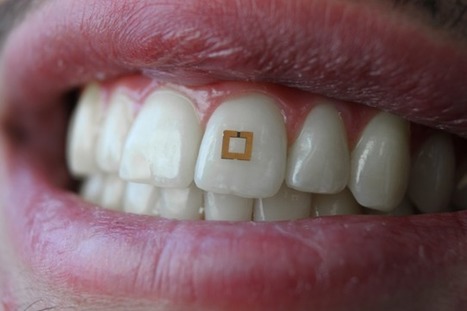 Tooth Sensor Measures Intake of Sugar, Salt, Alcohol | Longevity science | Scoop.it