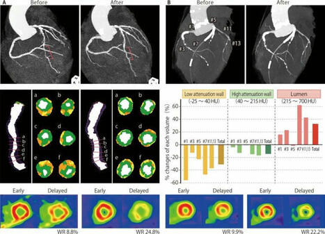 “Remarkable” Results – Scientists Say This Dietary Supplement Reversed Heart Damage | Healthcare: reloaded... | Scoop.it