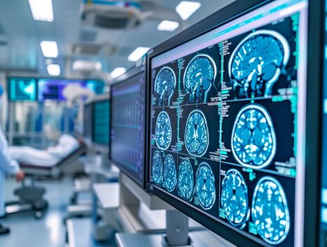 Un vaste essai clinique international apporte un &eacute;clairage in&eacute;dit sur un cancer p&eacute;diatrique c&eacute;r&eacute;bral | Life Sciences Universit&eacute; Paris-Saclay | Scoop.it