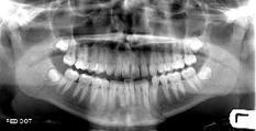 The Facial Bones | Radiology | Scoop.it