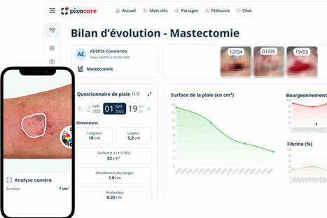 Pixacare lève 3 millions d’euros pour son logiciel de suivi de cicatrisation des plaies à distance | GAFAMS, STARTUPS & INNOVATION IN HEALTHCARE by PHARMAGEEK | Scoop.it