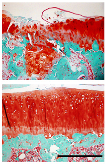 Futurity.org – Cartilage gets bum rap for osteoarthritis | Rheumatology-Rhumatologie | Scoop.it