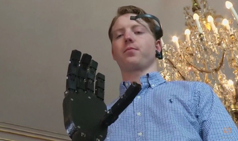 Humanoïdes : "Un génie de 19 ans imprime lui-même sa prothèse myostatique | Ce monde à inventer ! | Scoop.it