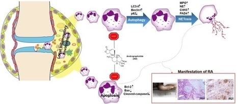 IJMS | Free Full-Text | Andrographolide Ameliorates Rheumatoid Arthritis by Regulating the Apoptosis&ndash;NETosis Balance of Neutrophils | Rheumatology-Rhumatologie | Scoop.it