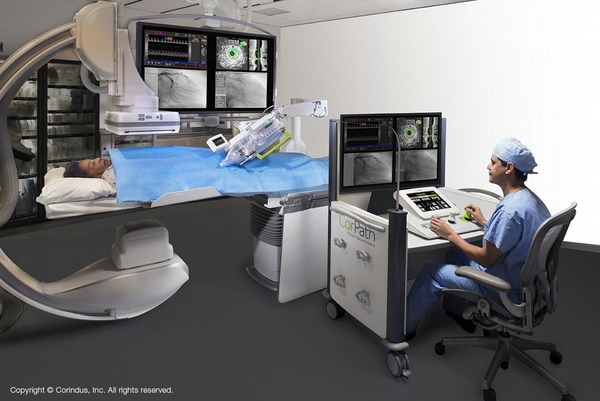 Siemens' newly acquired Corindus unit performs its first robotic brain aneurysm surgery | Neurovascular Intervention | Scoop.it