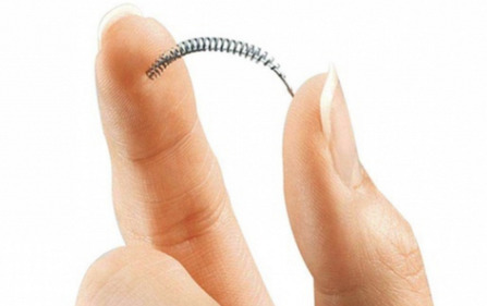 Contraception définitive : des spécialistes pointent les complications de la méthode Essure | Famille et sexualité | Scoop.it