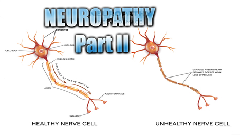 Neuropathy Presentation | El Paso, TX. | Part II | Doctor Of Chiropractic | Neuropathy "The Painful Enigma" | Scoop.it