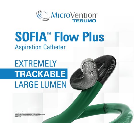 Microvention celebrates 10 years and more than 500,000 procedures with Sofia aspiration catheters | Neurovascular Intervention | Scoop.it