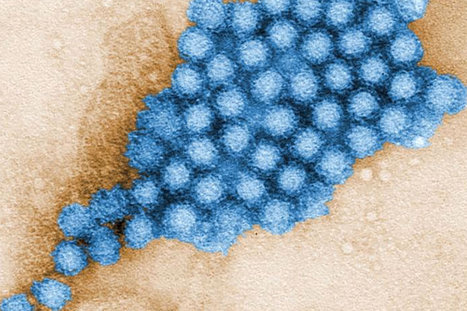 Gut Microbes Alter Characteristics of Norovirus Infection | Virus World | Scoop.it