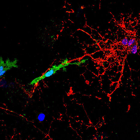 Envelope protein from Endogenous Retrovirus HERV-W responsible for tissue damage in&nbsp;Multiple sclerosis | Virus World | Scoop.it
