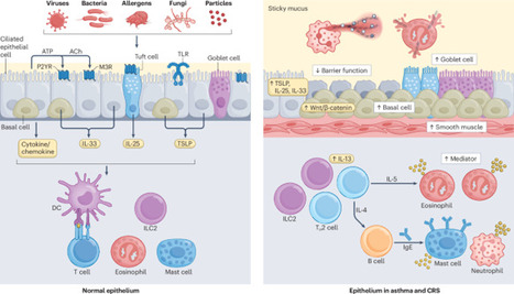 The immunology of asthma and chronic rhinosinusitis | Nature Reviews Immunology | Allergy (and clinical immunology) | Scoop.it