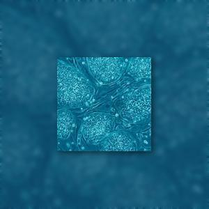 Researchers Identify Factors That Predict Better Survival After Stem Cell Transplantation (EHA 2012) | Hematology | Scoop.it
