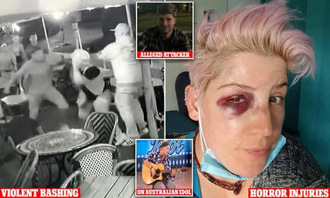 Horrific moment beloved Australian Idol contestant Casey Freeman is brutally bashed | Daily Mail Online | The Curse of Asmodeus | Scoop.it