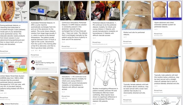 How to do Peritoneal Dialysis? | Peritoneal dialysis | Scoop.it