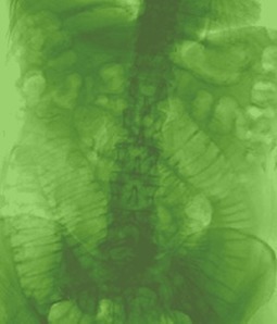 Clinical Anatomy | Radiological Atlas | Radiology | Scoop.it