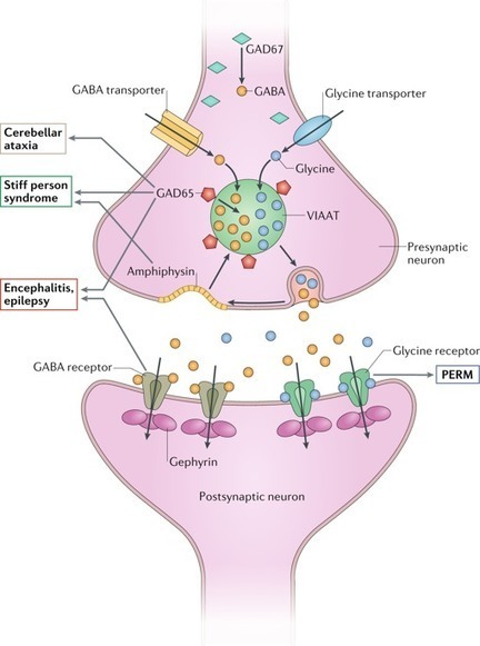 GAD antibodies in neurological disorders — insights and challenges | AntiNMDA | Scoop.it