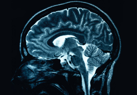 New Research Discovers That Depression Is An Allergic Reaction To Inflammation | Health Supreme | Scoop.it