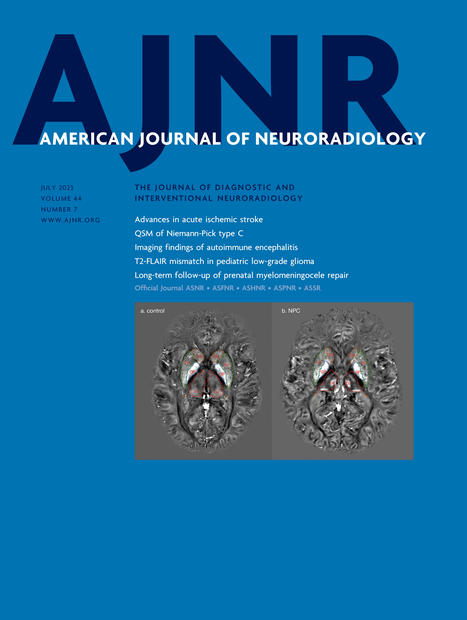MR Imaging Findings in a Large Population of Autoimmune Encephalitis | American Journal of Neuroradiology | AntiNMDA | Scoop.it