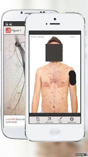 'Instagram for doctors' takes off | healthcare technology | Scoop.it