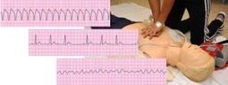 ACLS Algorithms and Manual | Daily Magazine | Scoop.it