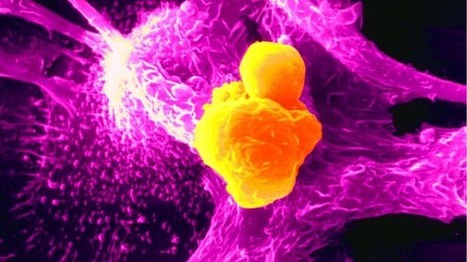 Neue Ansätze der Krebstherapie - Bonner Forscher lösen Bremse des Immunsystems | #Research #Cancer | 21st Century Innovative Technologies and Developments as also discoveries, curiosity ( insolite)... | Scoop.it