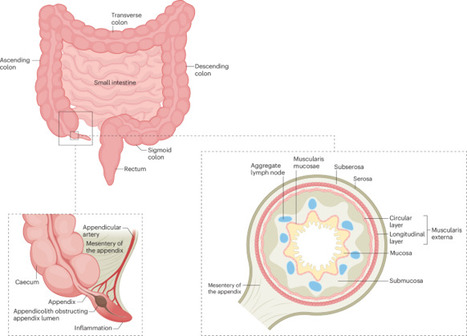 Appendicitis | Nature Reviews Disease Primers | Mucosal Immunity | Scoop.it