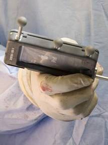 iPod Touch being used during surgery to improve accuracy | Digitized Health | Scoop.it