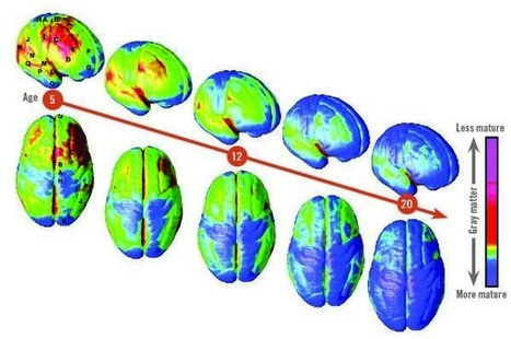 The Teen Brain: How Schools Can Help Students Manage Emotions and Make Better Decisions | Leading Schools | Scoop.it