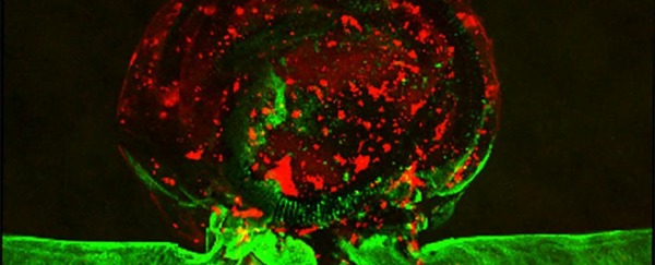 Scientists Created a 'Living' Aneurysm Out of Blood And Human Brain Cells | Neurovascular Intervention | Scoop.it