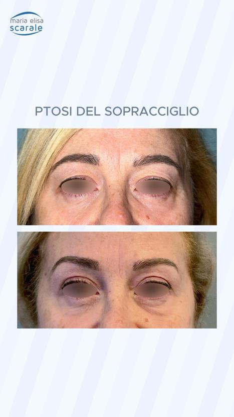 Riscopri la freschezza del tuo viso | Dr. Maria Elisa Scarale | The Eye News | Scoop.it