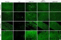 Prevention of muscular dystrophy in mice by CRISPR/Cas9–mediated editing of germline DNA | Genetic Engineering Publications - GEG Tech top picks | Scoop.it