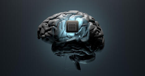 Implante cerebral chin&ecirc;s NEO marca uma nova era na medicina; conhe&ccedil;a | Inova&ccedil;&atilde;o Educacional | Scoop.it