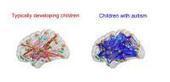 Social symptoms in autistic children may be caused by hyper-connected neurons | Fitness, Health, and Wellness | Scoop.it