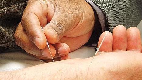 Un mystère de l'acupuncture expliqué par la science | La Sagesse de la Nature | Scoop.it