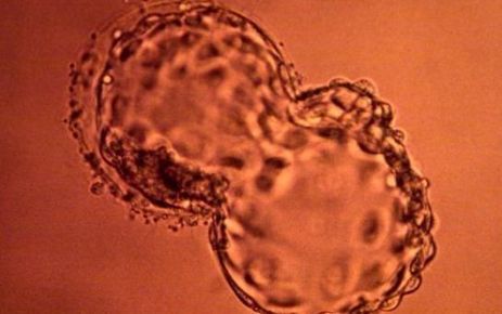 Malgr&eacute; l'interdiction, plus de 70 projets de recherche sur l'embryon | Bio&eacute;thique & Procr&eacute;ation | Scoop.it