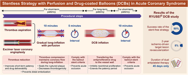 Novel Stentless Strategy With Perfusion and Drug-Coated Balloons for Treating Acute Coronary Syndrome | Interventional Cardiology | Scoop.it