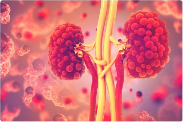 The impact of COVID-19 on dialysis patients | Peritoneal dialysis | Scoop.it