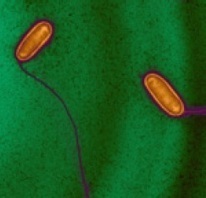 PROBIOTIQUE: Une petite bactérie à l’assaut de l'obésité | Microbiologie | Scoop.it