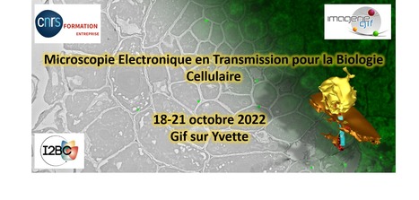 Training in Transmission electron microscopy for cell Biology | I2BC Paris-Saclay | Scoop.it