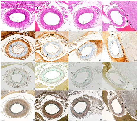 The Potential Therapeutic Effects of Tadalafil on the Endothelium in a Subarachnoid Hemorrhage Animal Model: Insights from Immunohistochemical Staining | Neurovascular Intervention | Scoop.it