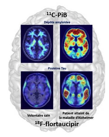 FOCUS PLATEFORME : L’Imagerie TEP « multi-traceur » pour une cartographie moléculaire du cerveau normal et pathologique ! | Life Sciences Université Paris-Saclay | Scoop.it