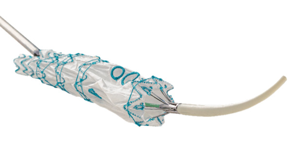 Terumo Aortic announces the first commercial implant of Fenestrated Treo in Asia | Transcatheter Treatment of Mitral Regurgitation | Scoop.it
